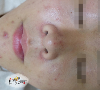전사진