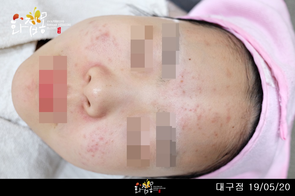 전후사진
