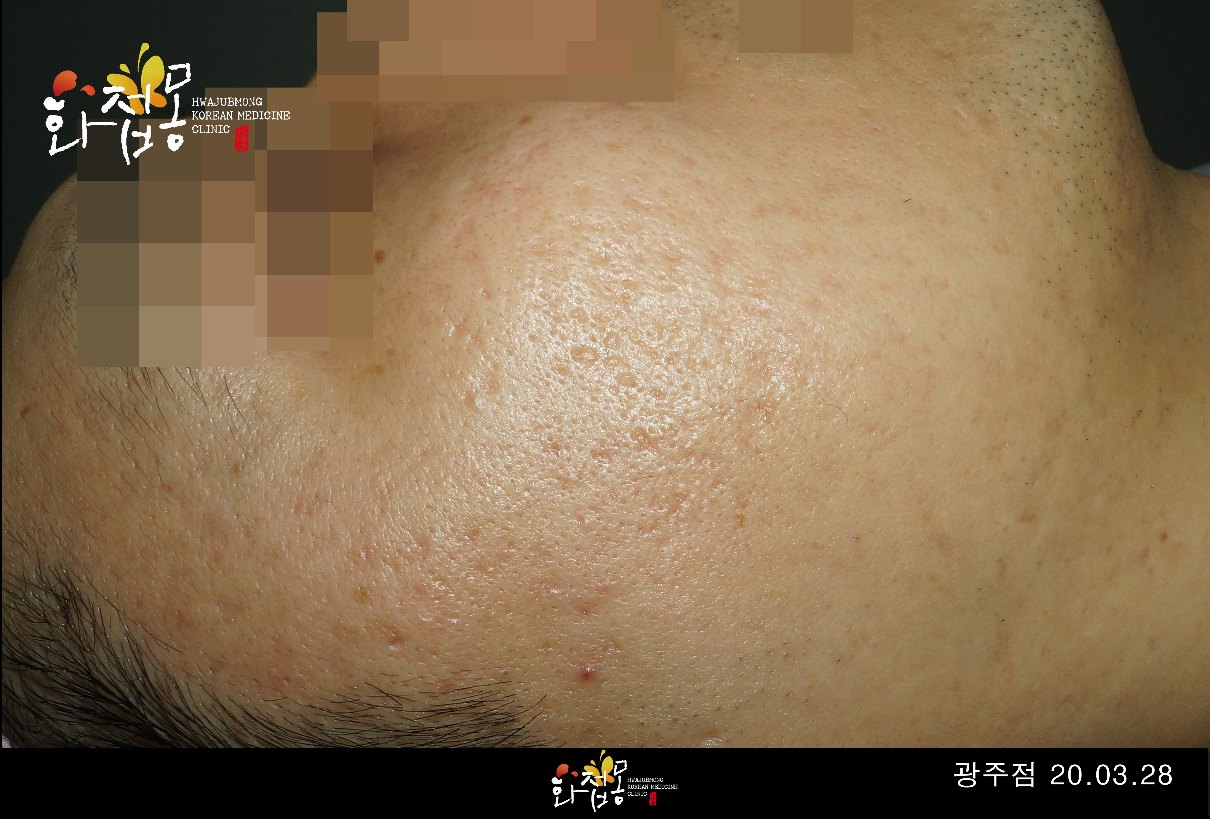 전후사진