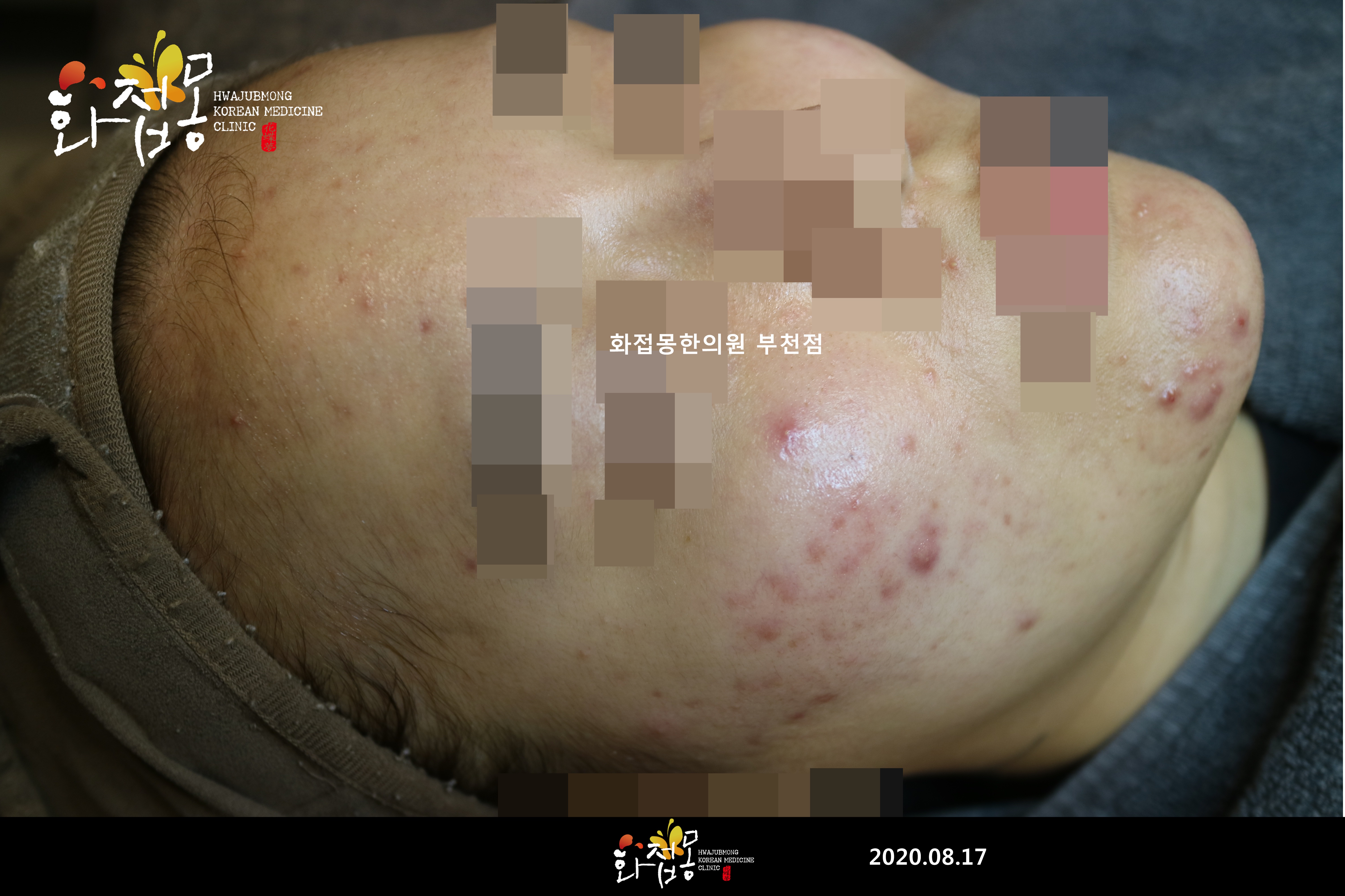 전후사진