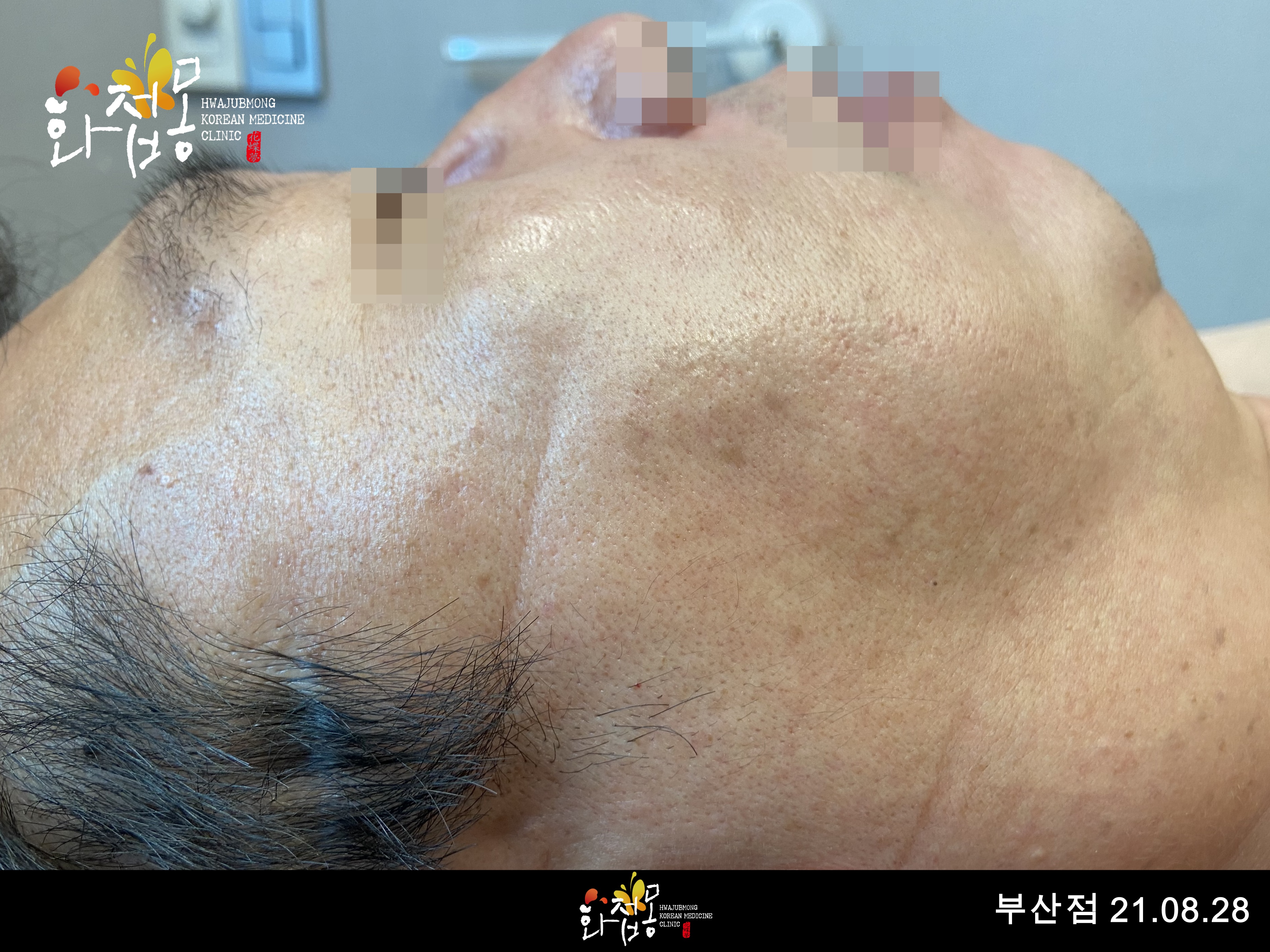전후사진