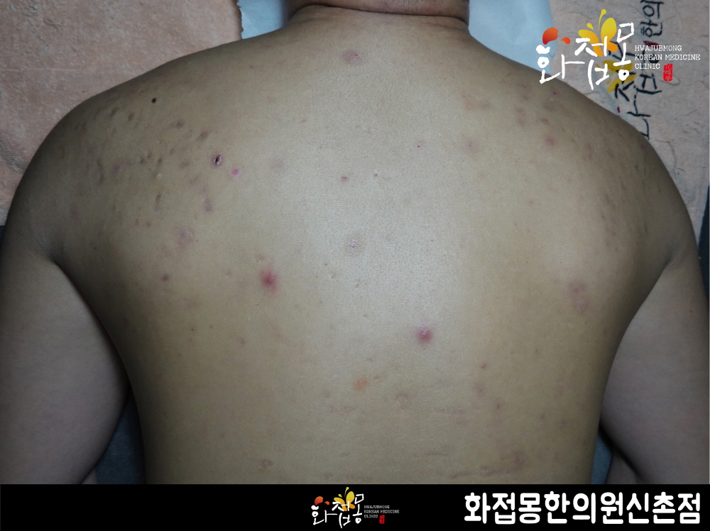 전후사진