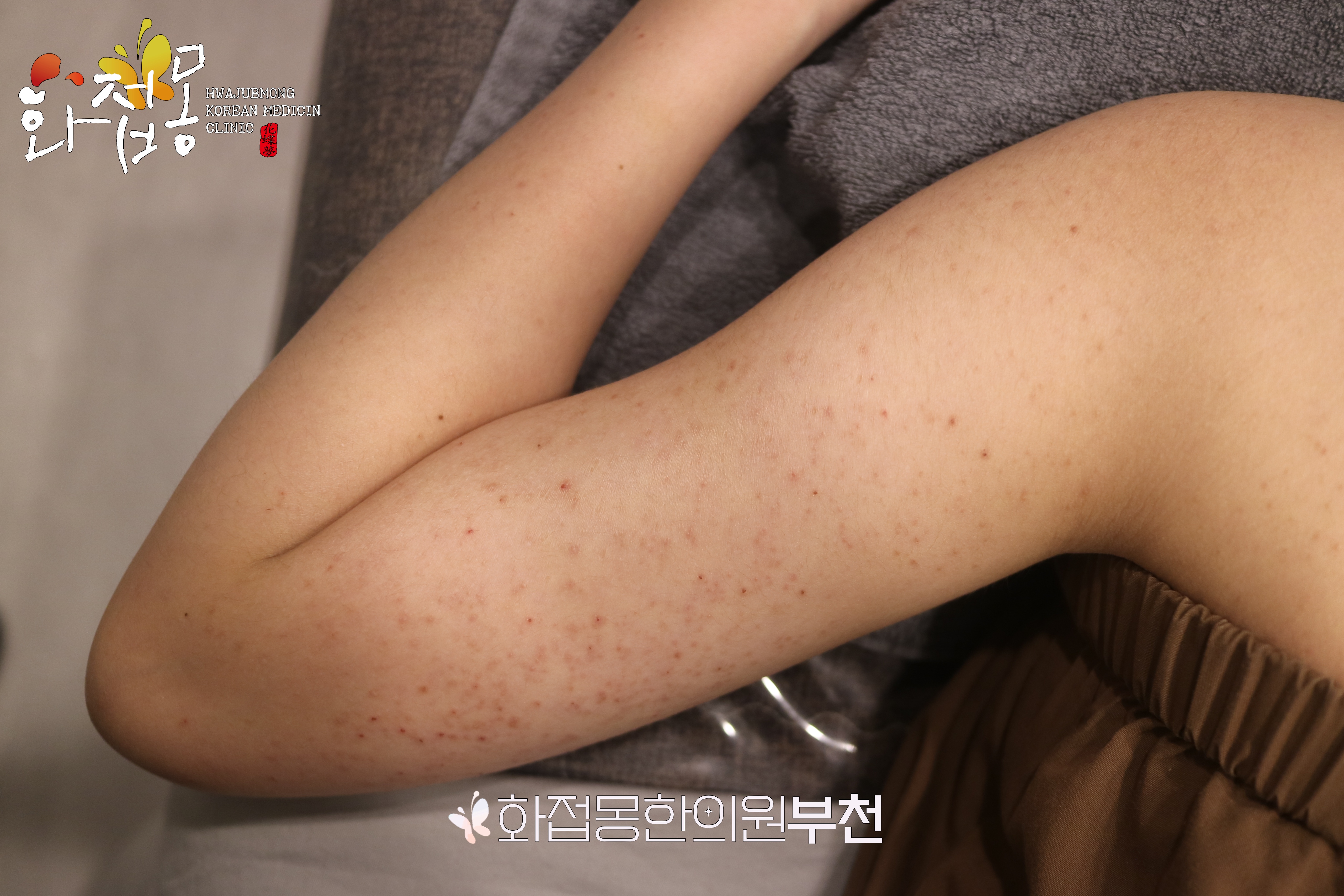 전후사진