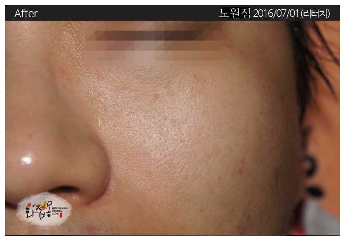전후사진