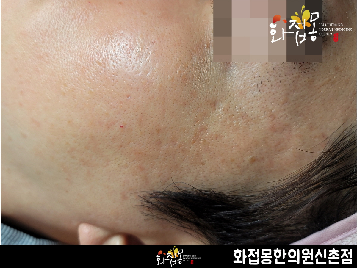 전후사진