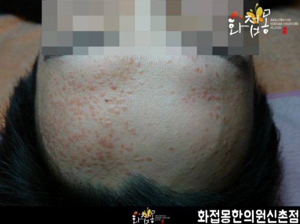 전후사진