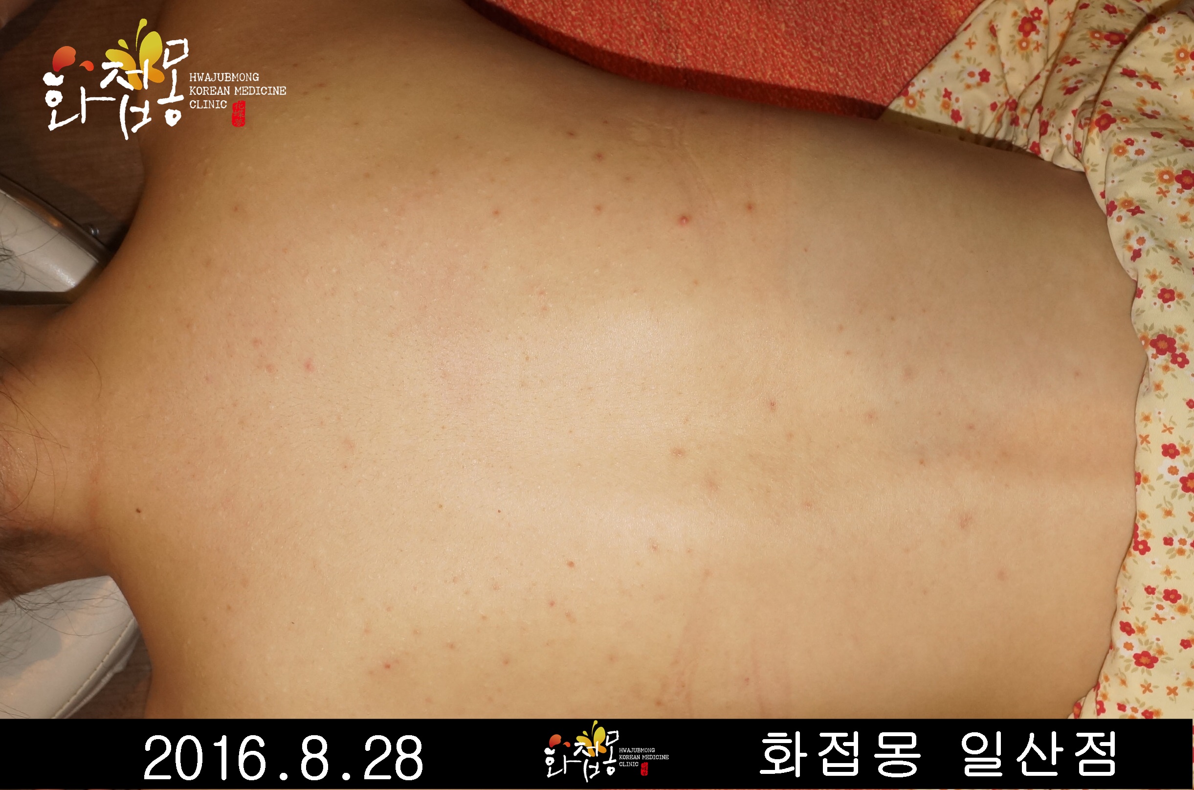 전후사진