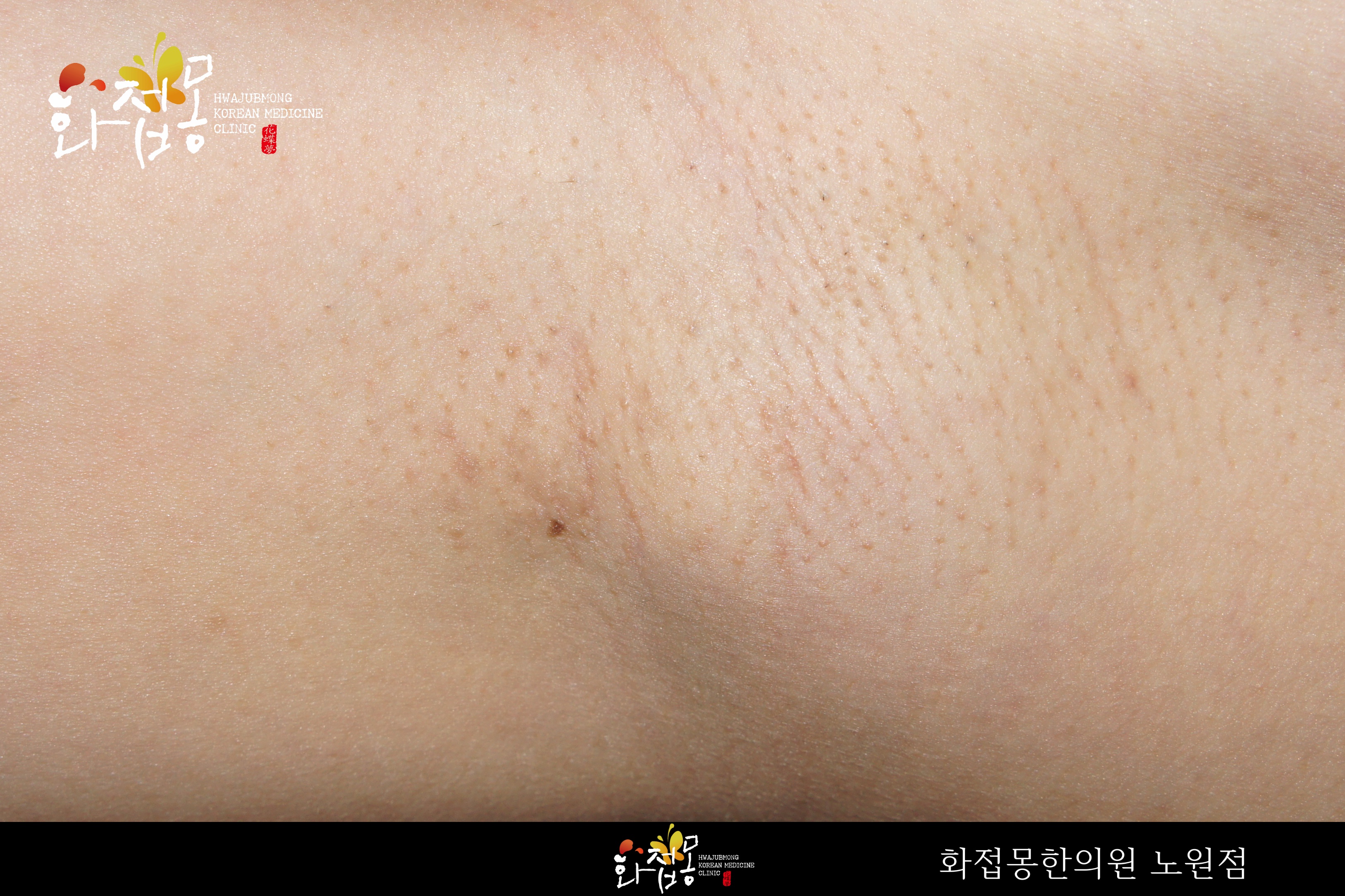 전후사진