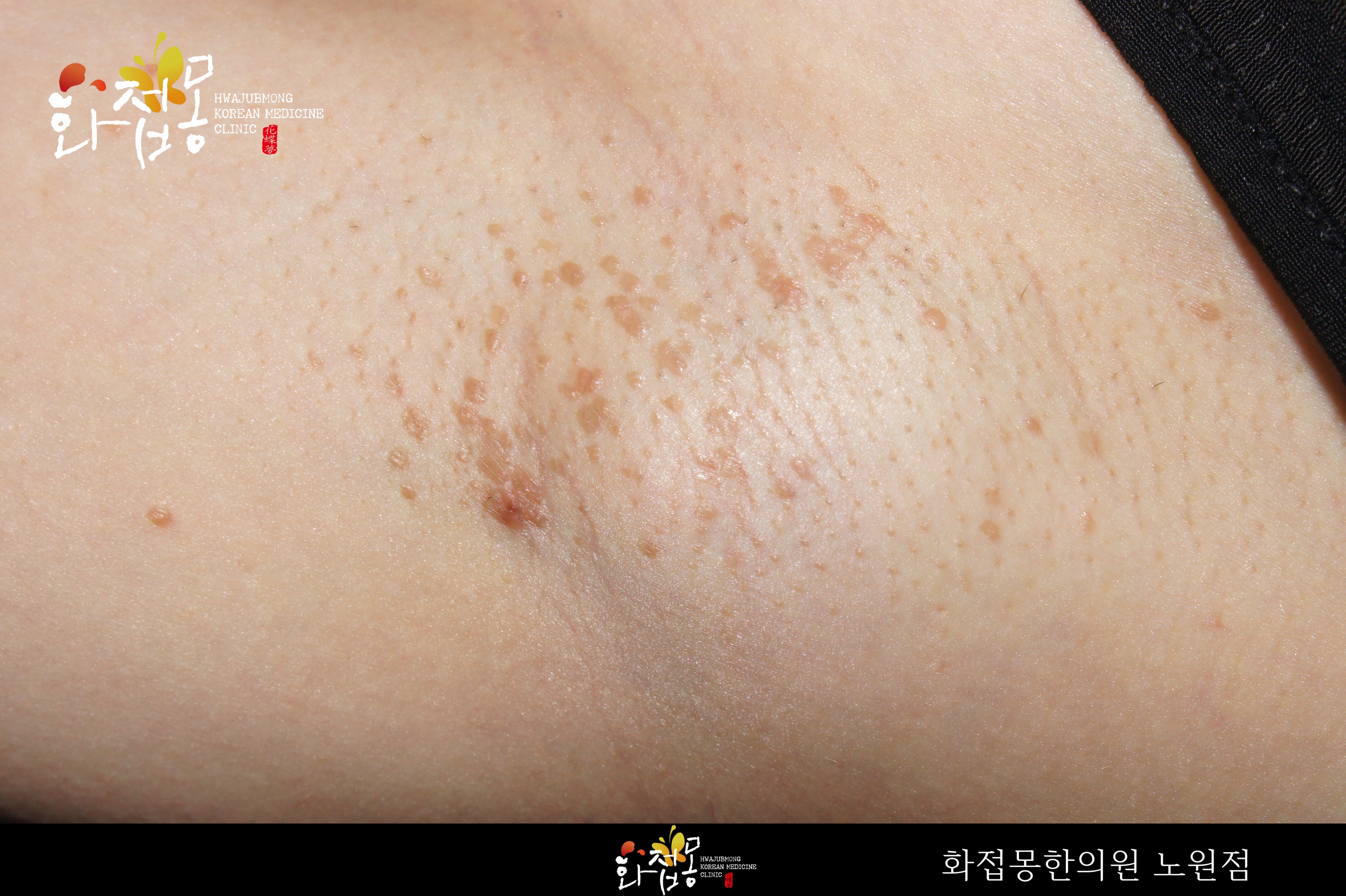 전후사진