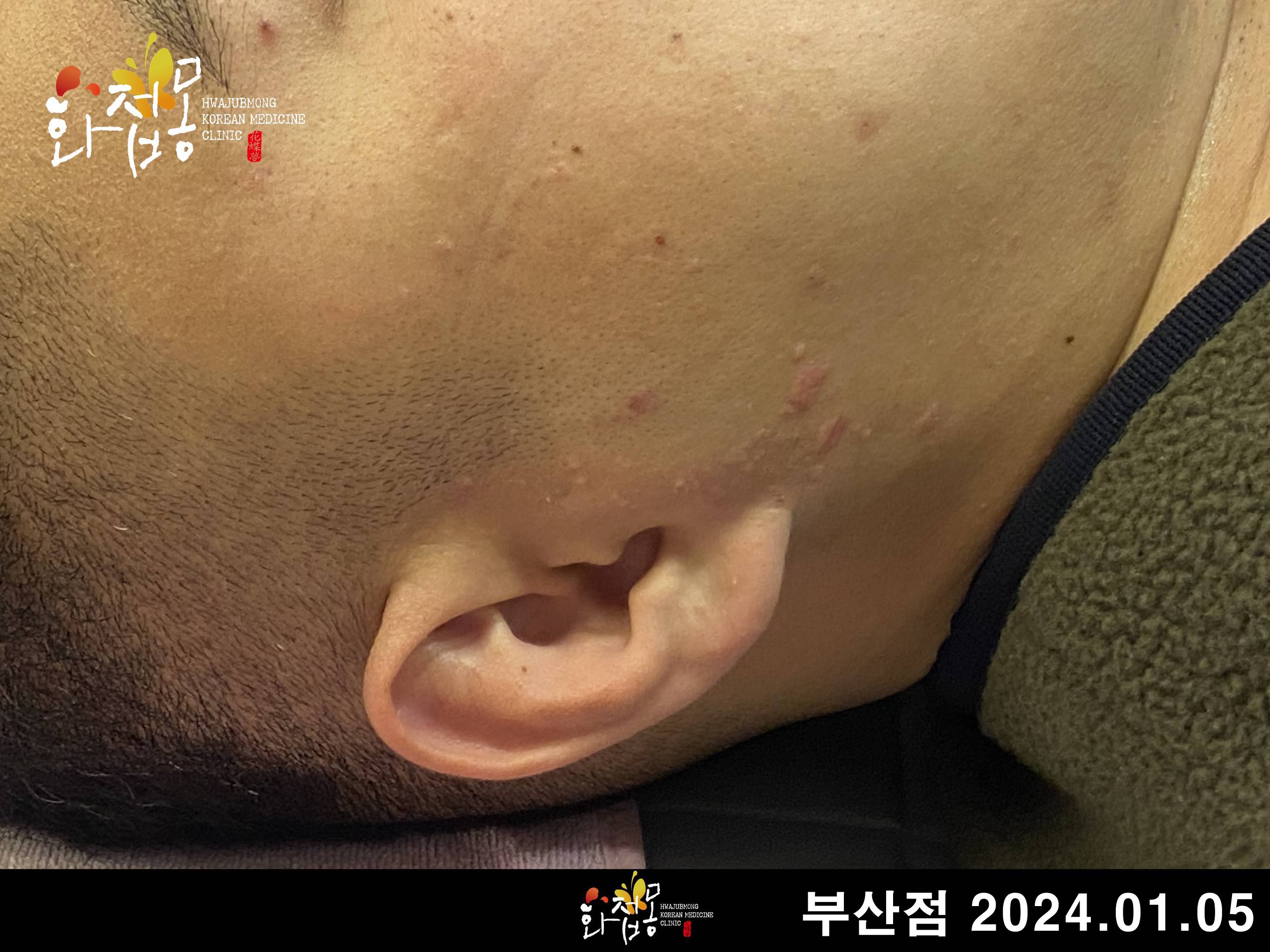 전후사진