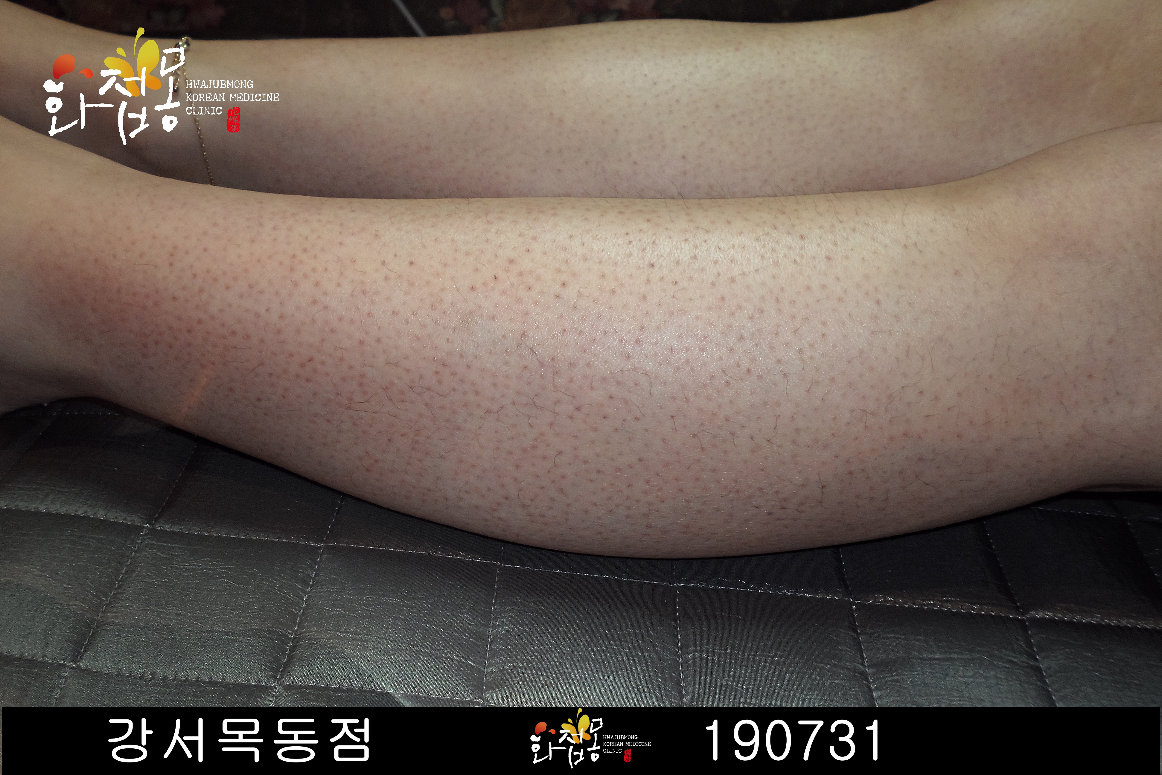 전후사진