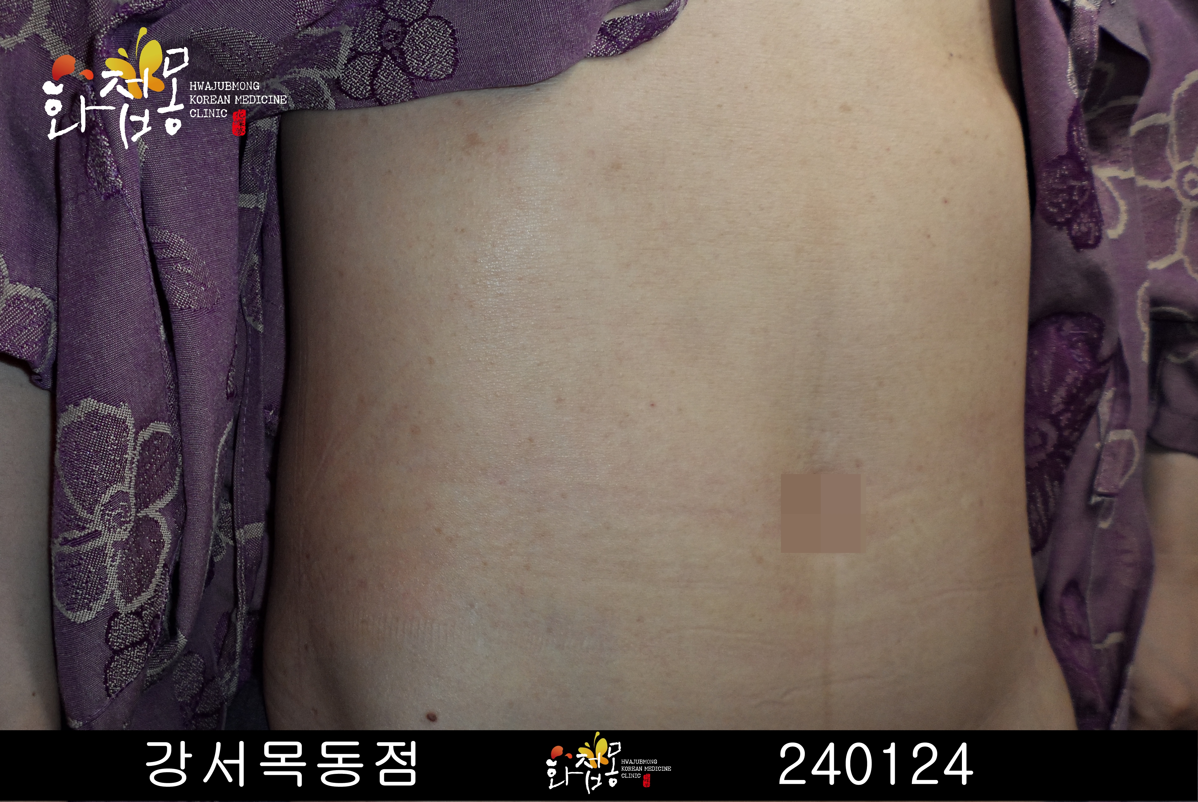 전후사진