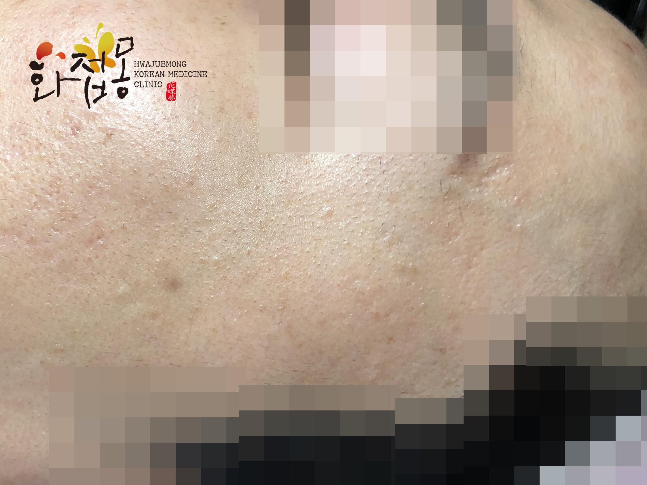 전후사진