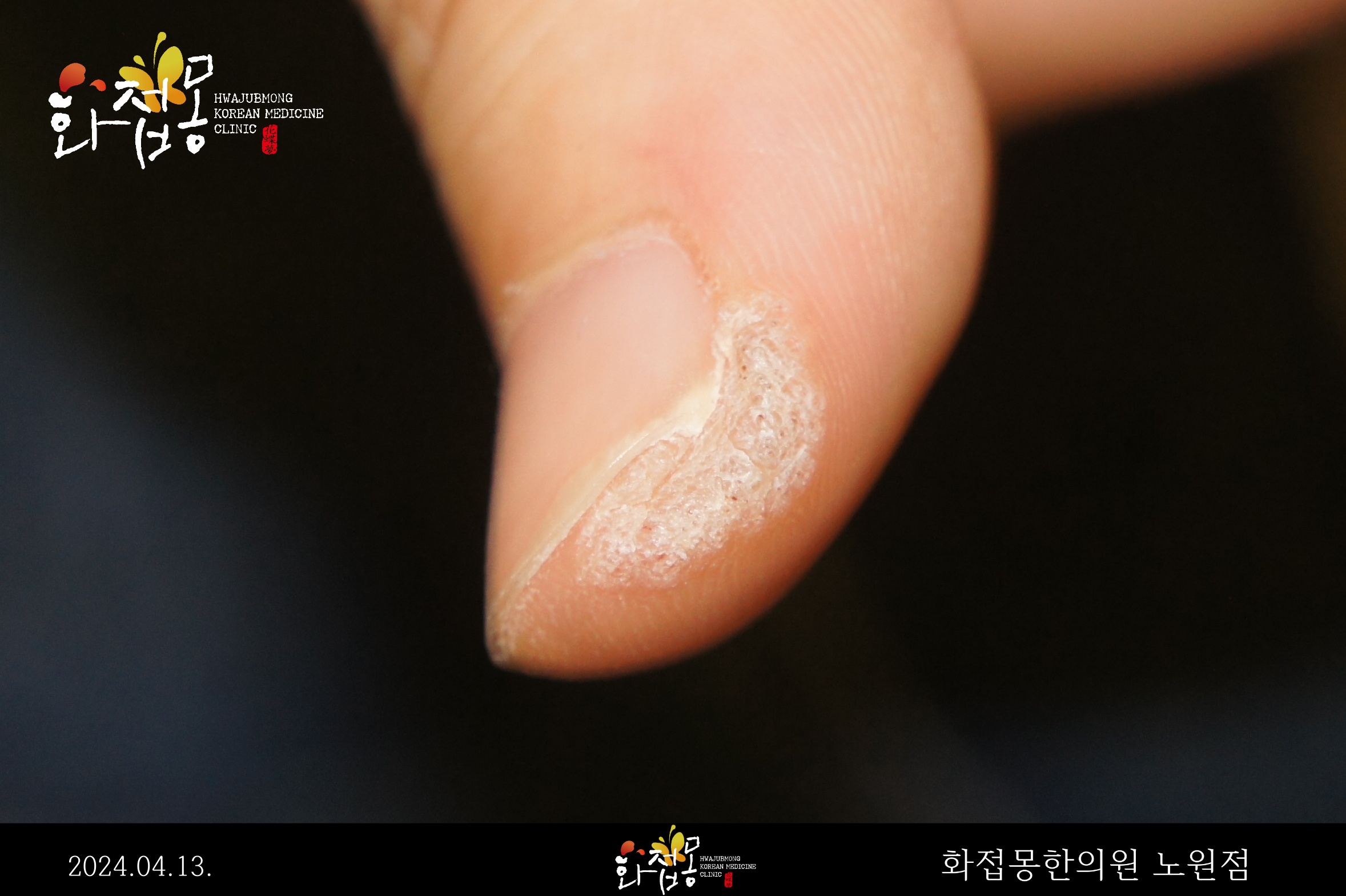 전후사진