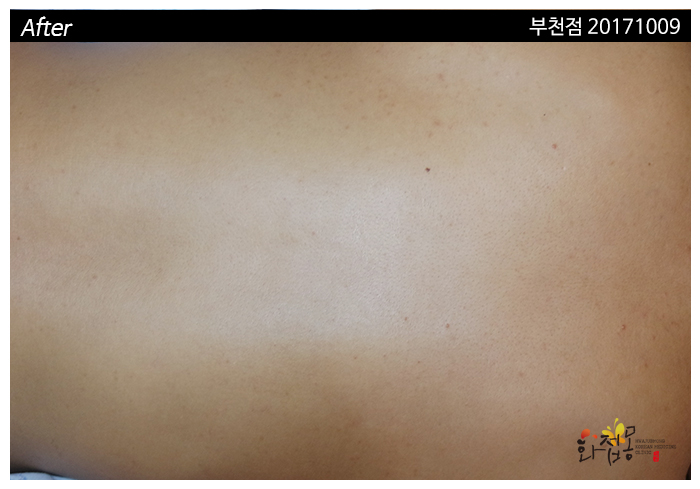 전후사진