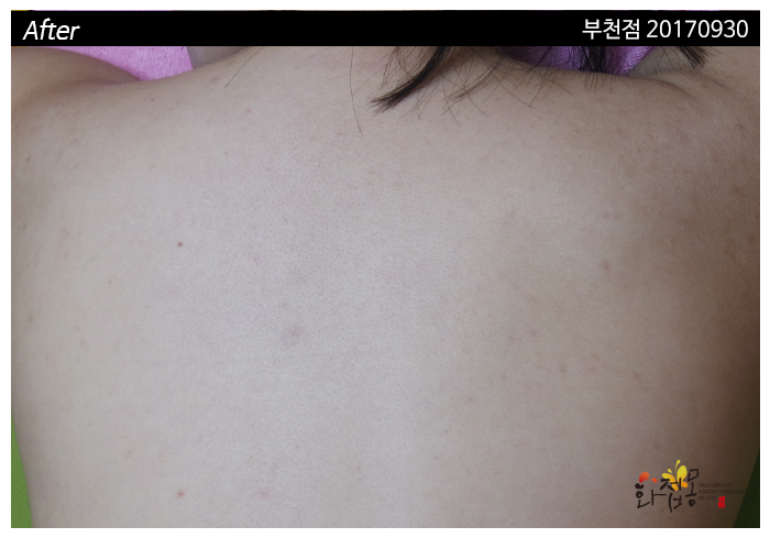 전후사진